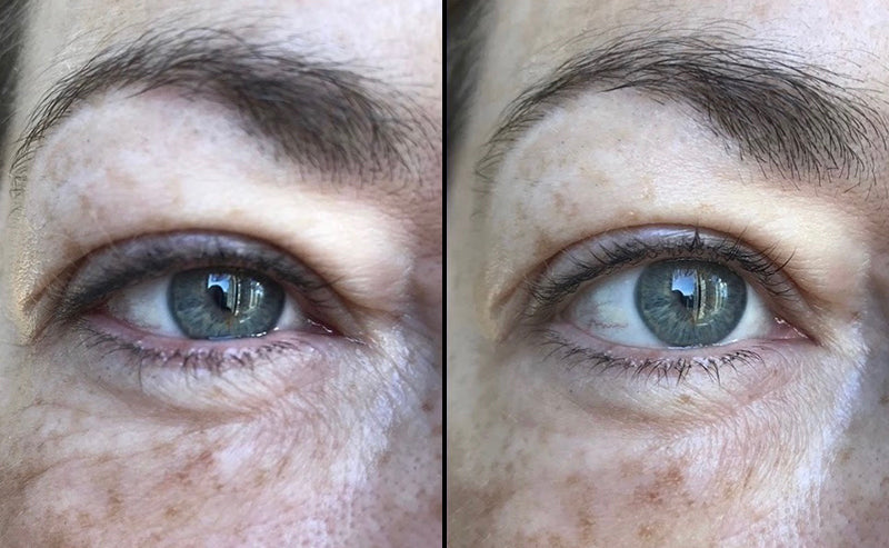 My GLOW HYDRATE™ journey